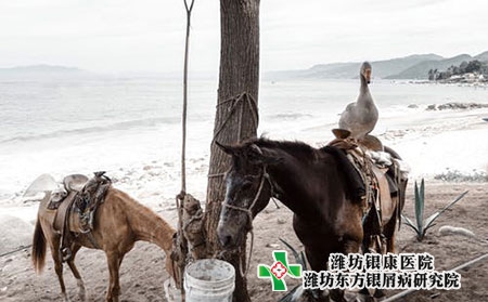 什么是头皮牛皮癣?如何治疗?