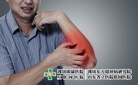 牛皮癣烫伤怎么处理?