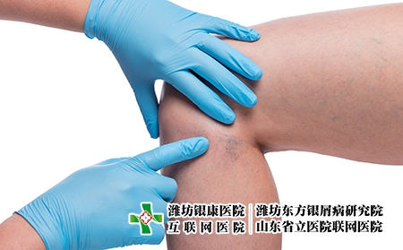 长在腿上的牛皮癣能够被治愈吗