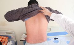 银屑病医院提示洗澡应注意方式
