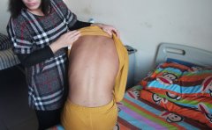 银屑病类型之间的表现症状？