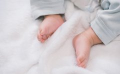 临沂地区治银屑病医院:如何护理宝宝银屑病患者?