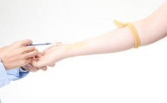 夏季牛皮癣患者皮肤搔痒这样缓解 临沂治疗牛皮癣医生