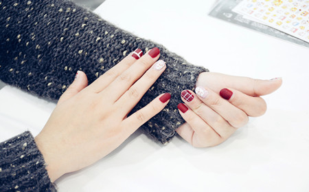 指甲牛皮癣,临沂治疗指甲牛皮癣医院