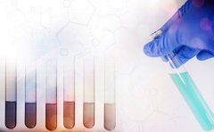 患寻常型银屑病后有什么注意事项吗