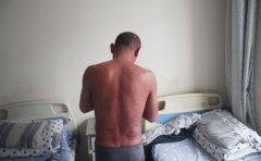 冬季牛皮癣饮食需注意五项原则