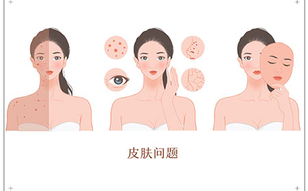 银屑病关节炎的症状有什么，临沂专家给你解答