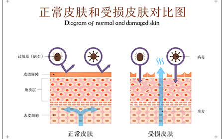 临沂口碑好的银屑病医院