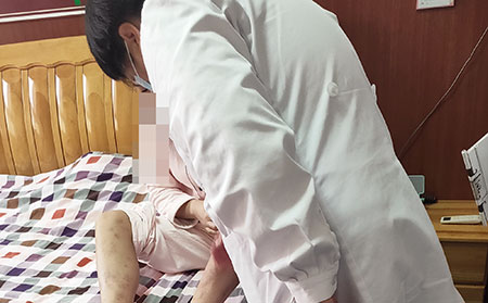 临沂治银屑病的医院哪家正规